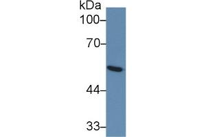 Detection of GLUT1 in Human Serum using Monoclonal Antibody to Glucose Transporter 1 (GLUT1)