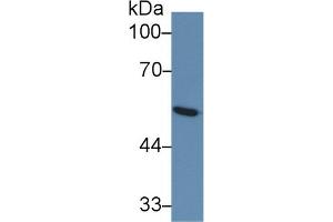 Detection of GLUT1 in Human Serum using Monoclonal Antibody to Glucose Transporter 1 (GLUT1) (GLUT1 anticorps  (AA 251-329))