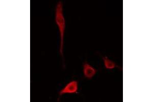 ABIN6274779 staining HepG2 cells by IF/ICC. (RPL34 anticorps)