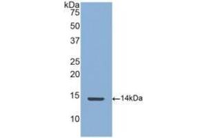Detection of Recombinant CTGF, Human using Polyclonal Antibody to Connective Tissue Growth Factor (CTGF) (CTGF anticorps  (AA 248-349))