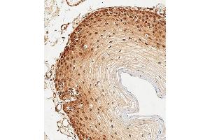 Immunohistochemical analysis of paraffin-embedded Human esophagus tissue using (ABIN6243695 and ABIN6578909) performed on the Leica® BOND RXm.