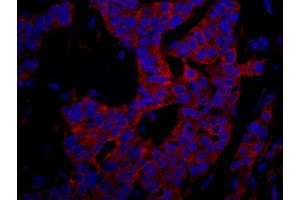 Immunofluorescence (IF) image for anti-Ubiquitin Protein Ligase E3 Component N-Recognin 4 (UBR4) (AA 5133-5183) antibody (ABIN7448995)