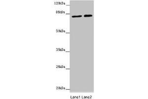 Western blot All lanes: DHX33 antibody at 16 μg/mL Lane 1: Hela whole cell lysate Lane 2: 293T whole cell lysate Secondary Goat polyclonal to rabbit IgG at 1/10000 dilution Predicted band size: 79, 61 kDa Observed band size: 79 kDa (DHX33 anticorps  (AA 116-357))