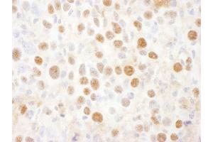 Immunohistochemistry (IHC) image for anti-Proteasome (Prosome, Macropain) 26S Subunit, Non-ATPase, 2 (PSMD2) (AA 50-100) antibody (ABIN7454976)