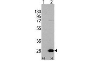 Western blot analysis of HSPB1 (arrow) using rabbit polyclonal HSPB1 Antibody 293 cell lysates (2 µg/lane) either nontransfected (Lane 1) or transiently transfected with the HSPB1 gene (Lane 2) (HSP27 anticorps  (Ser78))