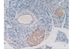 IHC-P analysis of Rat Pancreas Tissue, with DAB staining. (MAP4 anticorps  (AA 2-250))