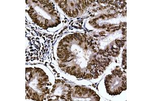 Immunohistochemistry of paraffin-embedded human colon using AHR Rabbit pAb (ABIN3015499, ABIN3015500, ABIN5663909 and ABIN6218543) at dilution of 1:100 (40x lens).