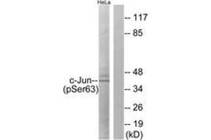 Western blot analysis of extracts from HeLa cells treated with UV, using c-Jun (Phospho-Ser63) Antibody. (C-JUN anticorps  (AA 31-80))