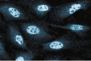 Immunofluorescence staining of human endothelial cells. (RAD50 anticorps  (AA 672-786))