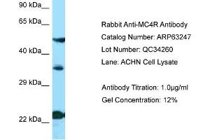 Western Blotting (WB) image for anti-Melanocortin 4 Receptor (MC4R) (N-Term) antibody (ABIN2789422) (MC4R anticorps  (N-Term))