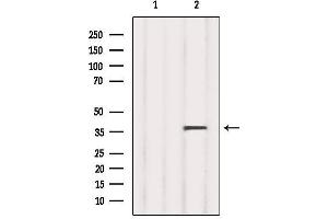 Western blot analysis of extracts from 293, using RLBP1 Antibody.
