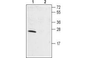 Western blot analysis of rat brain lysate: - 1. (KCNIP1 anticorps  (N-Term))