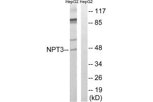 Western blot analysis of extracts from HepG2 cells, using SLC17A2 antibody. (SLC17A2 anticorps  (Internal Region))