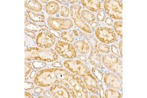 Immunohistochemistry of paraffin-embedded rat kidney using G Rabbit pAb (ABIN6133219, ABIN6140940, ABIN6140941 and ABIN6222644) at dilution of 1:450 (40x lens). (GALNT2 anticorps  (AA 442-571))