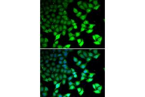 Immunofluorescence analysis of U2OS cells using KDM4B antibody (ABIN5973438). (KDM4B anticorps)