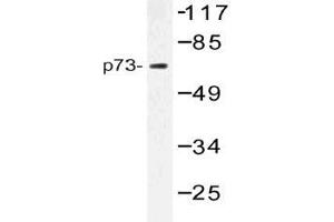 Western blot (WB) analysis of p73 antibody in extracts from Jurkat cells. (Tumor Protein p73 anticorps)
