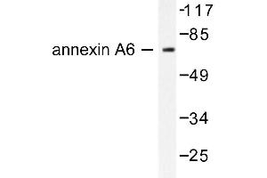 Image no. 1 for anti-Annexin A6 (ANXA6) antibody (ABIN265310) (ANXA6 anticorps)