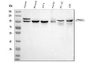 Western blot analysis of CTNND1 using anti-CTNND1 antibody (ABIN7602220). (CTNND1 anticorps  (AA 64-930))
