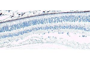 ABIN570667 Negative Control showing staining of paraffin embedded Human Retina, with no primary antibody. (ARR3 anticorps  (C-Term))