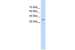 WB Suggested Anti-SERPINB5 Antibody Titration:  0. (SERPINB5 anticorps  (Middle Region))