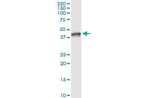 anti-NAD(P) Dependent Steroid Dehydrogenase-Like (NSDHL) (AA 1-373) antibody