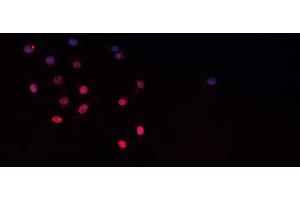 ABIN6267413 staining K-562 cells by IF/ICC. (CEBPB anticorps  (pThr235))