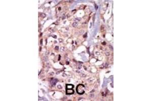 Immunohistochemistry (IHC) image for anti-Nuclear Receptor Subfamily 4, Group A, Member 3 (NR4A3) antibody (ABIN3003456)