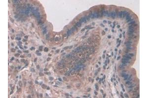 DAB staining on IHC-P; Samples: Mouse Liver Tissue (SNX18 anticorps  (AA 411-614))
