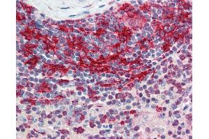 Anti-STAT6 antibody IHC of human spleen.