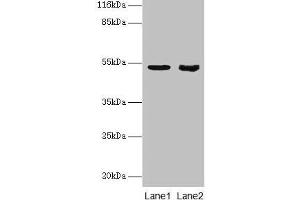 Western blot All lanes: SKP2 antibody at 2 μg/mL Lane 1: Jurkat whole cell lysate Lane 2: Hela whole cell lysate Secondary Goat polyclonal to rabbit IgG at 1/10000 dilution Predicted band size: 48, 47, 24 kDa Observed band size: 48 kDa (SKP2 anticorps  (AA 1-424))