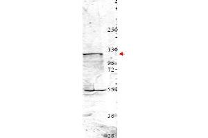 Image no. 1 for anti-Neural Precursor Cell Expressed, Developmentally Down-Regulated 4, E3 Ubiquitin Protein Ligase (NEDD4) (Internal Region) antibody (ABIN401453) (NEDD4 anticorps  (Internal Region))