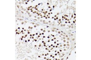 Immunohistochemistry of paraffin-embedded Rat testis using EP300 antibody (ABIN6127823, ABIN6140193, ABIN6140194 and ABIN6216844) at dilution of 1:100 (40x lens). (p300 anticorps  (AA 1-270))