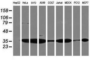 Image no. 3 for anti-Proteasome Subunit alpha 4 (PSMA4) antibody (ABIN1500458) (PSMA4 anticorps)