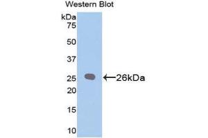 Western Blotting (WB) image for anti-B-Cell CLL/lymphoma 2 (BCL2) (AA 2-208) antibody (FITC) (ABIN1858118)