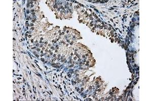 Immunohistochemical staining of paraffin-embedded prostate tissue using anti-ARNT mouse monoclonal antibody. (ARNT anticorps)