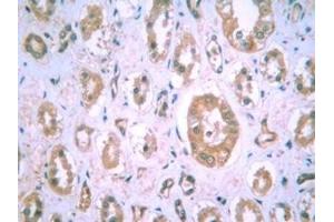 Image no. 4 for anti-Hypoxia Inducible Factor 1, alpha Subunit (Basic Helix-Loop-Helix Transcription Factor) (HIF1A) (AA 432-528) antibody (ABIN363203)