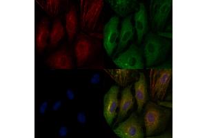 ABIN6260784 and ABIN6276639 staining  cells by IF/ICC.