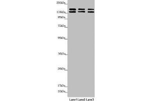 Western blot All lanes: UACA antibody at 5. (UACA anticorps  (AA 1-90))
