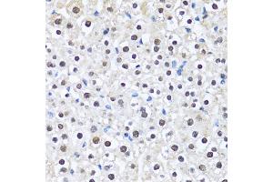 Immunohistochemistry of paraffin-embedded mouse liver using CCAR2 antibody (ABIN2563550) at dilution of 1:100 (40x lens). (CCAR2 anticorps)