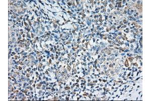 Immunohistochemical staining of paraffin-embedded Human Kidney tissue using anti-TTC32 mouse monoclonal antibody. (TTC32 anticorps)