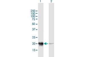 Western Blot analysis of PDC expression in transfected 293T cell line by PDC MaxPab polyclonal antibody. (Phosducin anticorps  (AA 1-194))