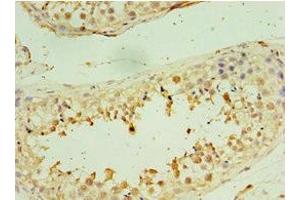 Immunohistochemistry of paraffin-embedded human testis tissue using ABIN7171228 at dilution of 1:100 (Syntaxin 16 anticorps  (AA 1-300))