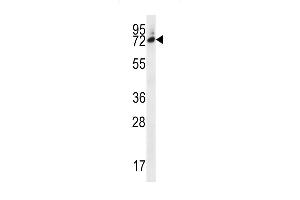 SIX5 Antibody (Center) (ABIN656668 and ABIN2845908) western blot analysis in MDA-M cell line lysates (35 μg/lane). (Six5 anticorps  (AA 257-286))