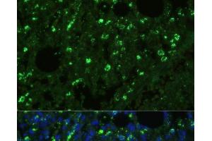 Immunofluorescence analysis of Mouse lung cells using TREM2 Polyclonal Antibody at dilution of 1:100. (TREM2 anticorps)