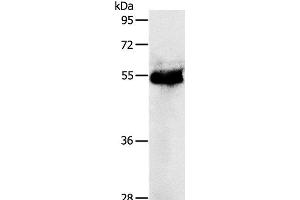 Western Blot analysis of Human colon cancer tissue using PRKAR1B Polyclonal Antibody at dilution of 1:1200