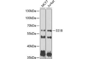 Western blot analysis of extracts of various cell lines, using SS18 antibody (ABIN6133185, ABIN6148473, ABIN6148474 and ABIN6222754) at 1:1000 dilution. (SS18 anticorps  (AA 1-240))