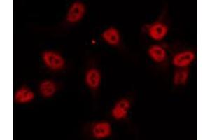 ABIN6274520 staining Hela by IF/ICC. (AKIP1 anticorps  (Internal Region))