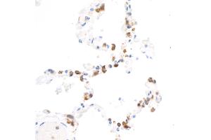 Immunohistochemistry (IHC) image for anti-Integrin alpha M (ITGAM) (AA 17-334) antibody (ABIN7453958)