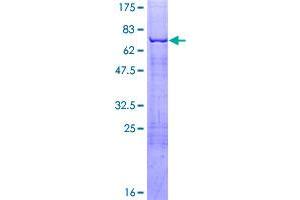 Image no. 1 for Kruppel-Like Factor 1 (erythroid) (KLF1) (AA 1-362) protein (GST tag) (ABIN1308727)