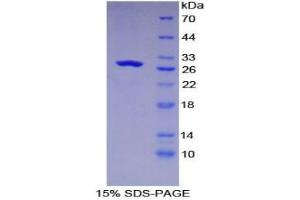SDS-PAGE analysis of Human GLUD1 Protein. (GLUD1 Protéine)